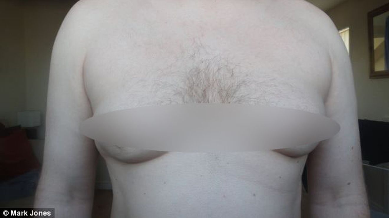 A vrut sa scape de "sanii de femeie" si sa arate ca un barbat normal! Rezultatul este insa INGROZITOR!