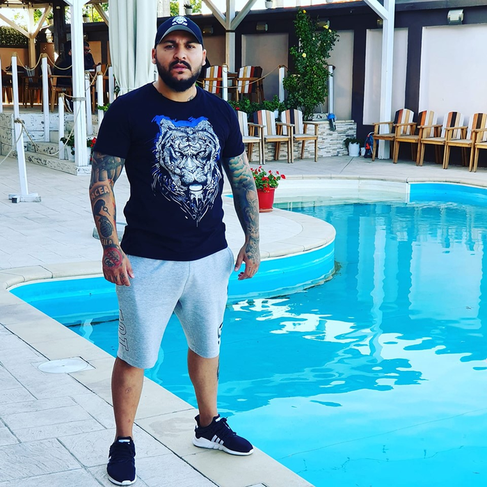Cum arată Dani Mocanu după ce a făcut implant de păr la o clinică din Turcia!