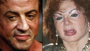 Sylvester Stallone si mama acestuia, clienti fideli ai cabinetelor de remodelare plastica!