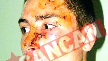 Mutilat cu un ciob, la discoteca