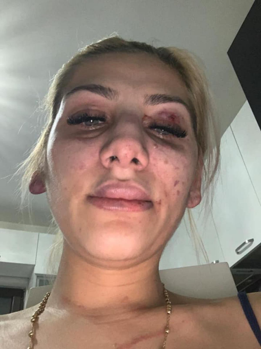 Yoannes, noi acuzații la adresa lui Tzancă Uraganu! „A bătut-o pe fata asta până a avortat”