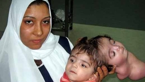 Medicii au rămas fără cuvinte când au văzut ce a născut aceasta femeie! Cazul care a impresionat o lume intreaga