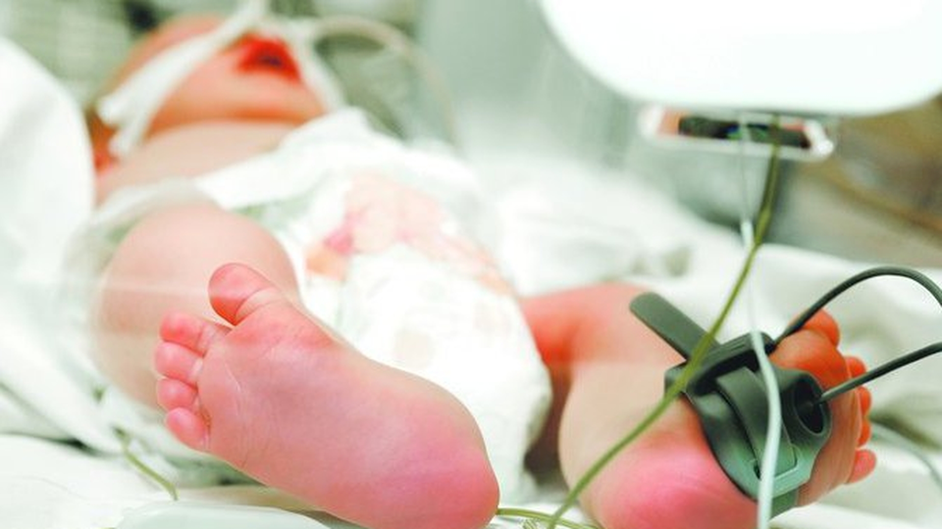Un copil de un an si jumatate e pe moarte dupa ce mama lui l-a scapat din brate! A cazut in cap de la zece metri