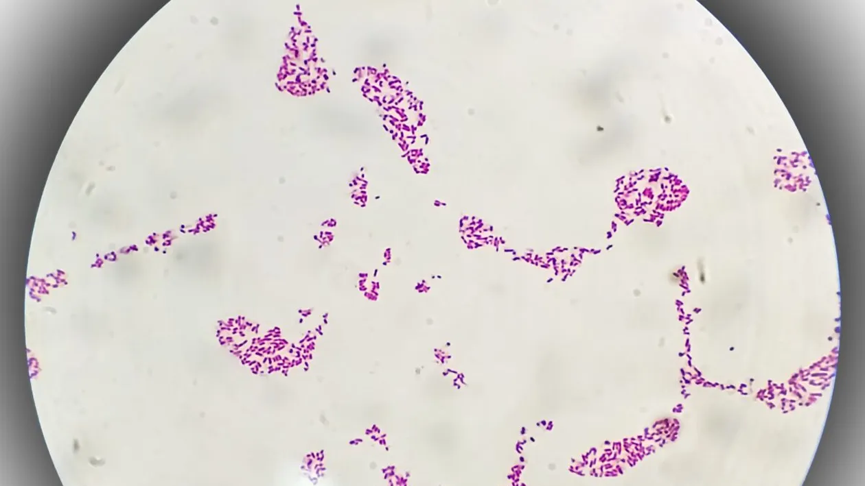 O boală veche de milenii devine tot mai rezistentă la antibiotice. Avertismentul cercetătorilor