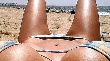 Ai vergeturi si nu stii cum sa scapi de ele? Ce trebuie sa faci pentru a avea niste picioare de fotomodel