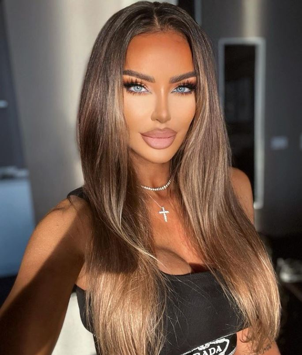 Bianca Drăguşanu s-a operat din nou la faţă şi nu mai iese din casă fără cagulă! Cum arată acum