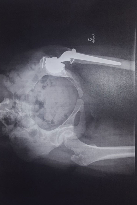 Una dintre radiografiile Kassandrei
