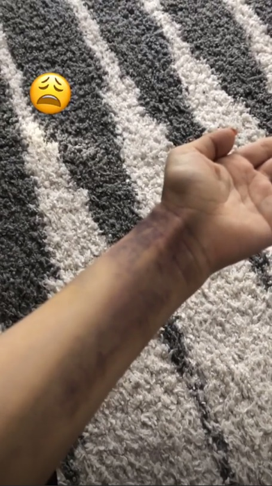 Andreea Bălan, plină de vânătăi. A răbufnit duminică dimineața la ora 10:16: „Aceasta este o poză facută la câteva ore după ce mi-am revenit din stopul cardio-respirator”