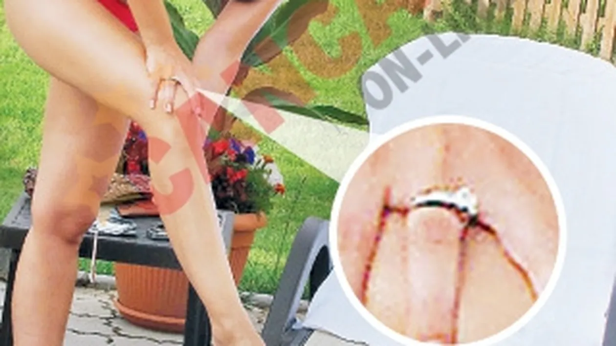 S-a logodit cu doctorul!