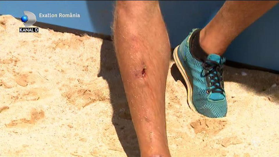 EXATLON 10 APRILIE. Ionuț ”Jaguarul” a făcut ditamai gaura în picior, iar Cazacu l-a acuzat că se preface. Ori esti bărbat, ori…