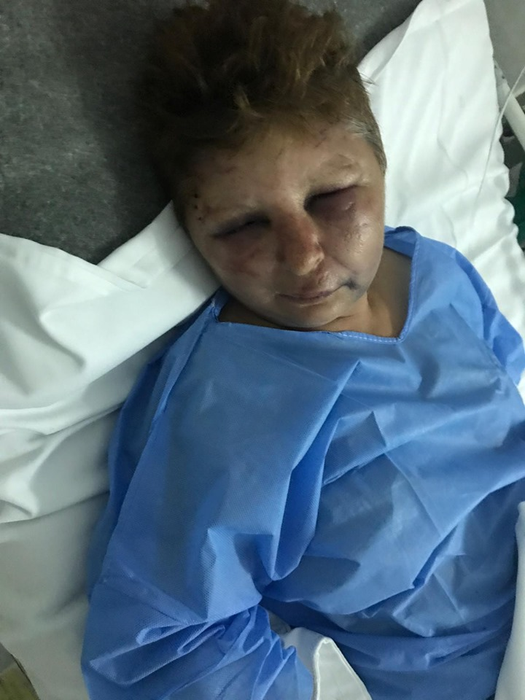 Femeie bătută de un polițist din Potcoava. Agentul, care ar fi vrut să o violeze, cercetat penal și disciplinar