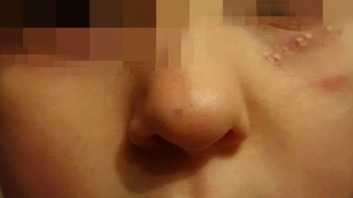 Incident şocant în Vaslui! O educatoare ar fi lovit peste faţă o fetiţă, iar apoi a dat-o cu fond de ten!