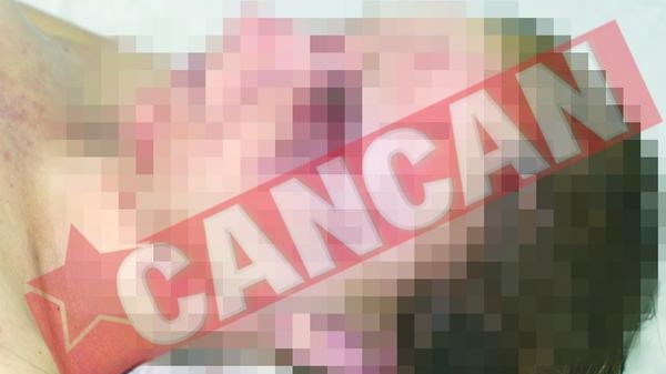 Asasinata in stil mafiot pe un deal de langa Suceava