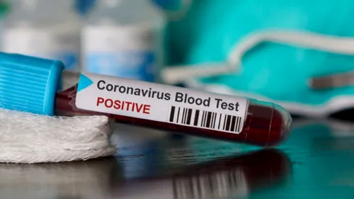 Coronavirus România. Numărul deceselor din cauza COVID-19 a ajuns la 469