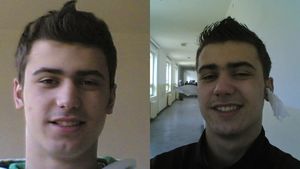 Îl recunoști? Sportivul celebru din România tocmai și-a făcut implant de păr