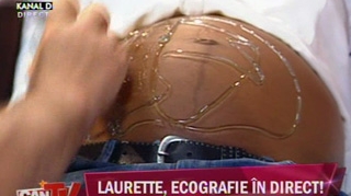 VIDEO PREMIERA! Ecografie in direct! Laurette si-a vazut copilul nenascut pe post!