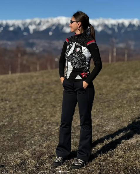 Ce problemă de sănătate are Adela Popescu. I se trage din copilărie: „Sătul de tupeul meu…”