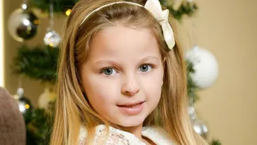 Colegii o strigau renul Rudolf! Cum arata inainte de operatie aceasta fetita