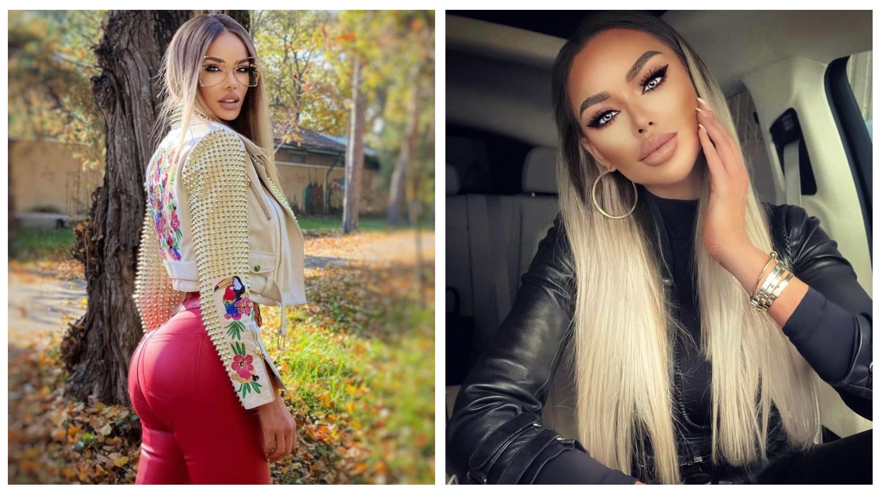 Bianca Drăgușanu a ajuns din nou pe mâna medicului estetician. La ce intervenție a fost supusă vedeta