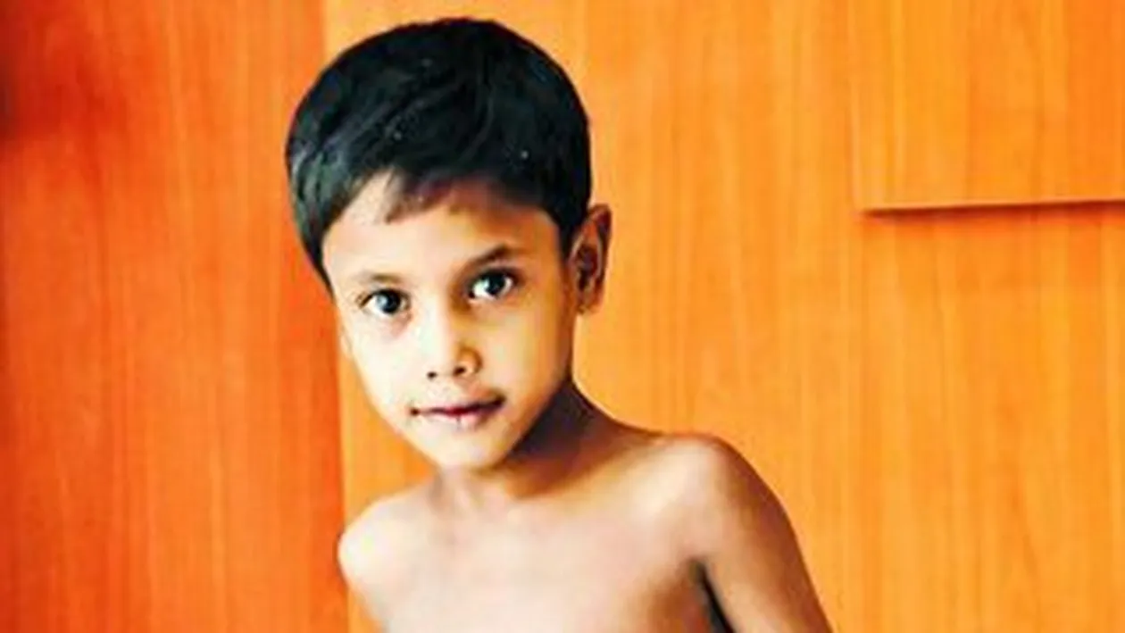 I-au scos fratele din burta