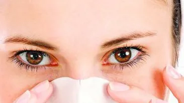 Cum sa-ti confectionezi singura benzile pentru puncte negre