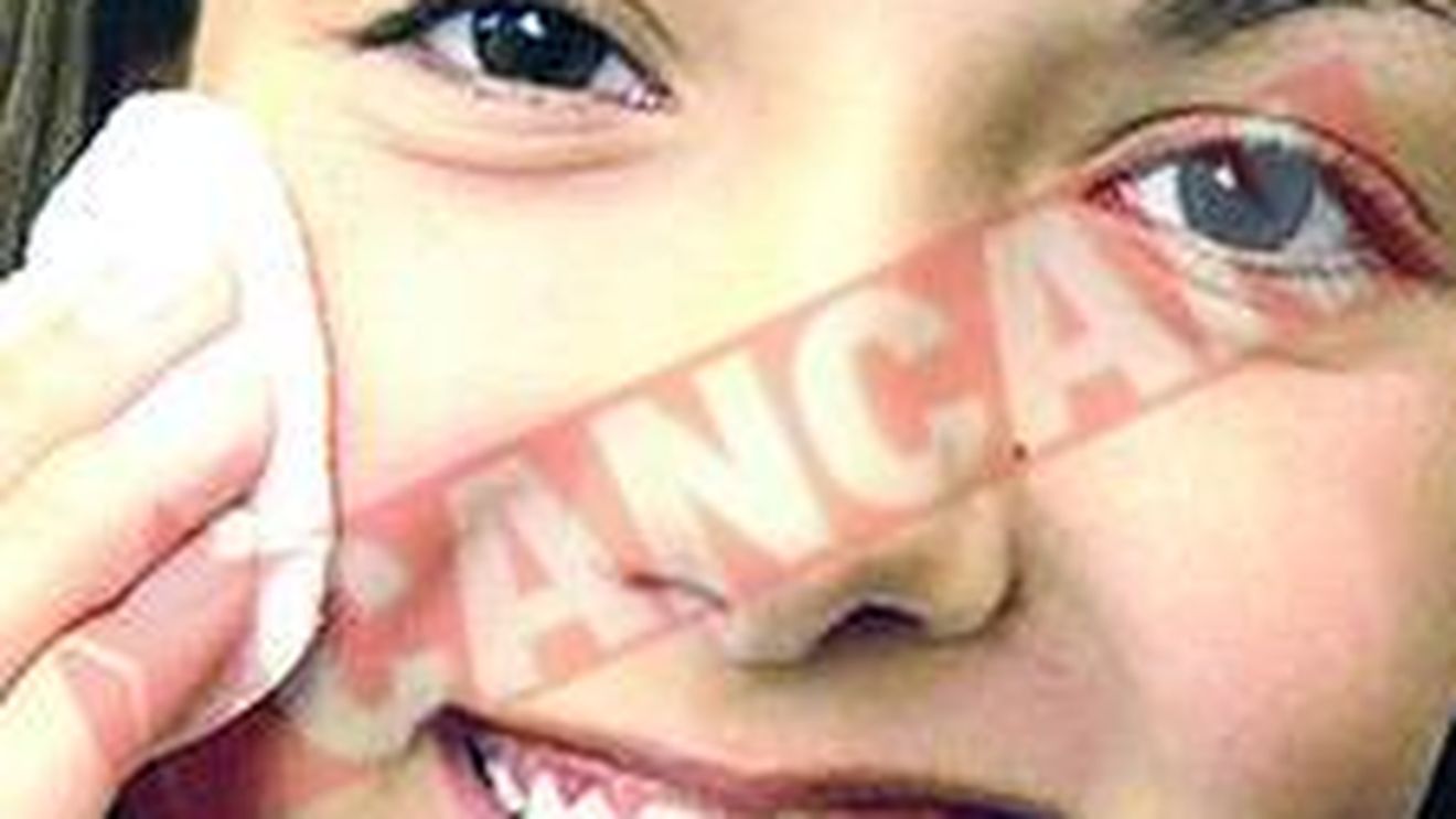 Metode de prevenire a acneei