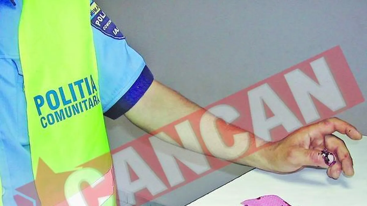 Un betiv violent l-a muscat pe un politist de deget