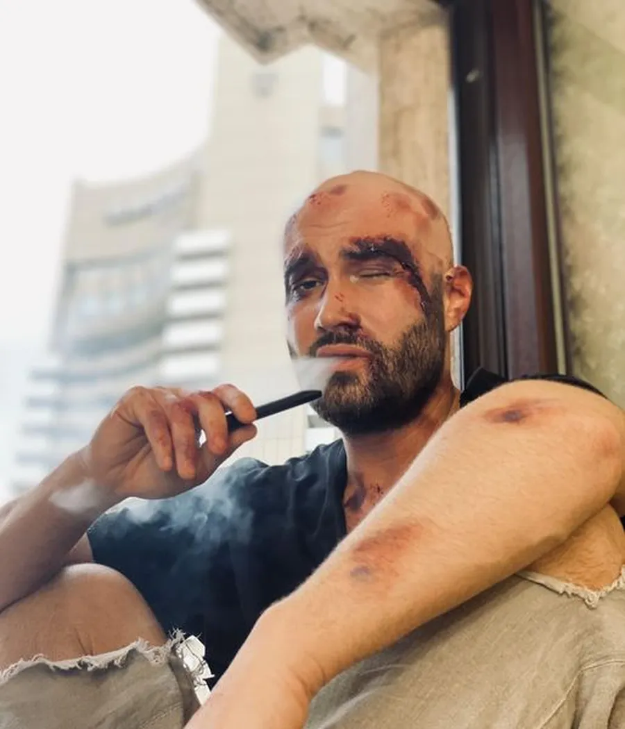 Mihai Bendeac a fost înfrânt în "meciul" de vineri seara (Foto: Facebook)