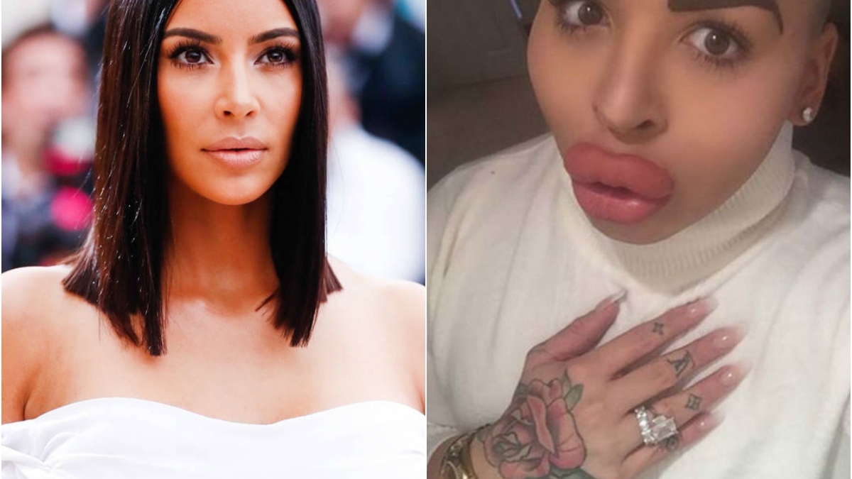 Acest tânăr de 23 de ani a cheltuit 150 de mii de dolari pentru a arăta precum KIM KARDASHIAN