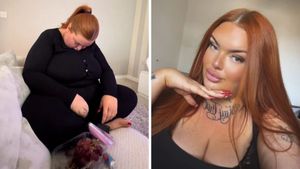 Femeia care leșină de fiecare dată când râde. Ce afecțiune rară are Chelsea Coombes