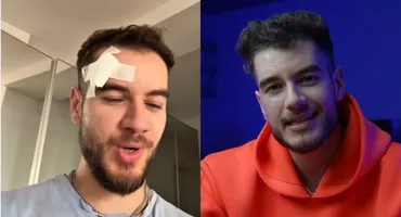 Ce s-a întâmplat cu Theo Zeciu. Fostul concurent de la Power Couple a apărut lovit la cap