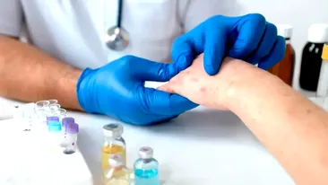 Un nou caz de lepră, confirmat în Europa! Țara apropiată de România este în alertă