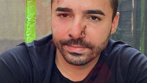 Clanul "Buricea" din Brăila, tentativă de asasinare! Victima își strigă disperarea în CANCAN.RO. "Am fost lovit și înjunghiat. Poliția nu face nimic!" + "El a dat startul: omorâți-l!"