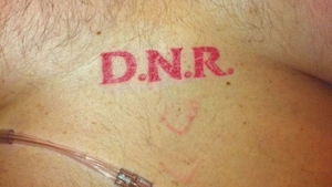 Un bărbat a ajuns în stare gravă la spital, iar medicii au rămas şocaţi după ce au văzut ce tatuaj avea pe piept