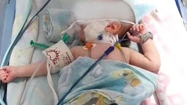 A murit David Andrei, bebelușul din Sebeș care s-a născut cu o malformație gravă