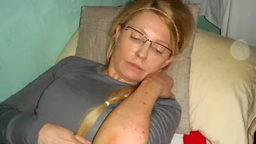 Iulia Timosenko nu a fost batuta in inchisoare, spun procurorii! Vezi cum s-a ales cu toate vanataile de pe corp!