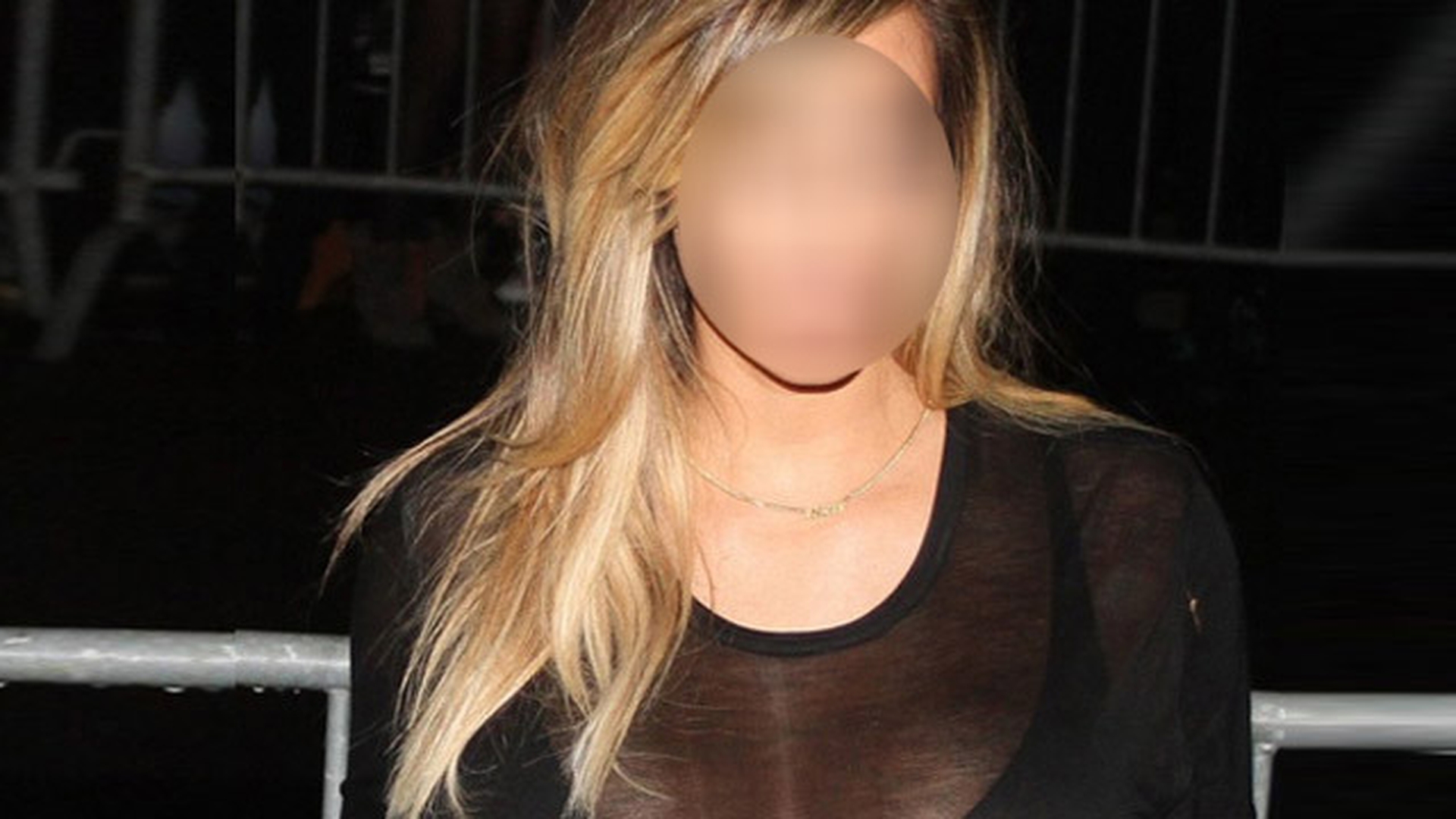 A inceput sa CHELEASCA dupa sarcina! Vedeta cunoscuta in toata lumea care a patit asa ceva! Arata INGROZITOR