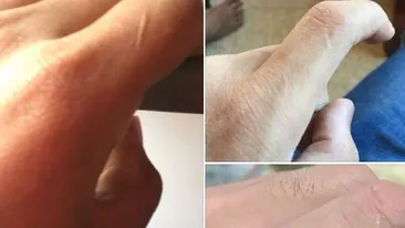 Ce înseamnă dacă ai o cicatrice pe degetul de la mâna stângă: „Persoana care te-a iubit în viața anterioară nu....”