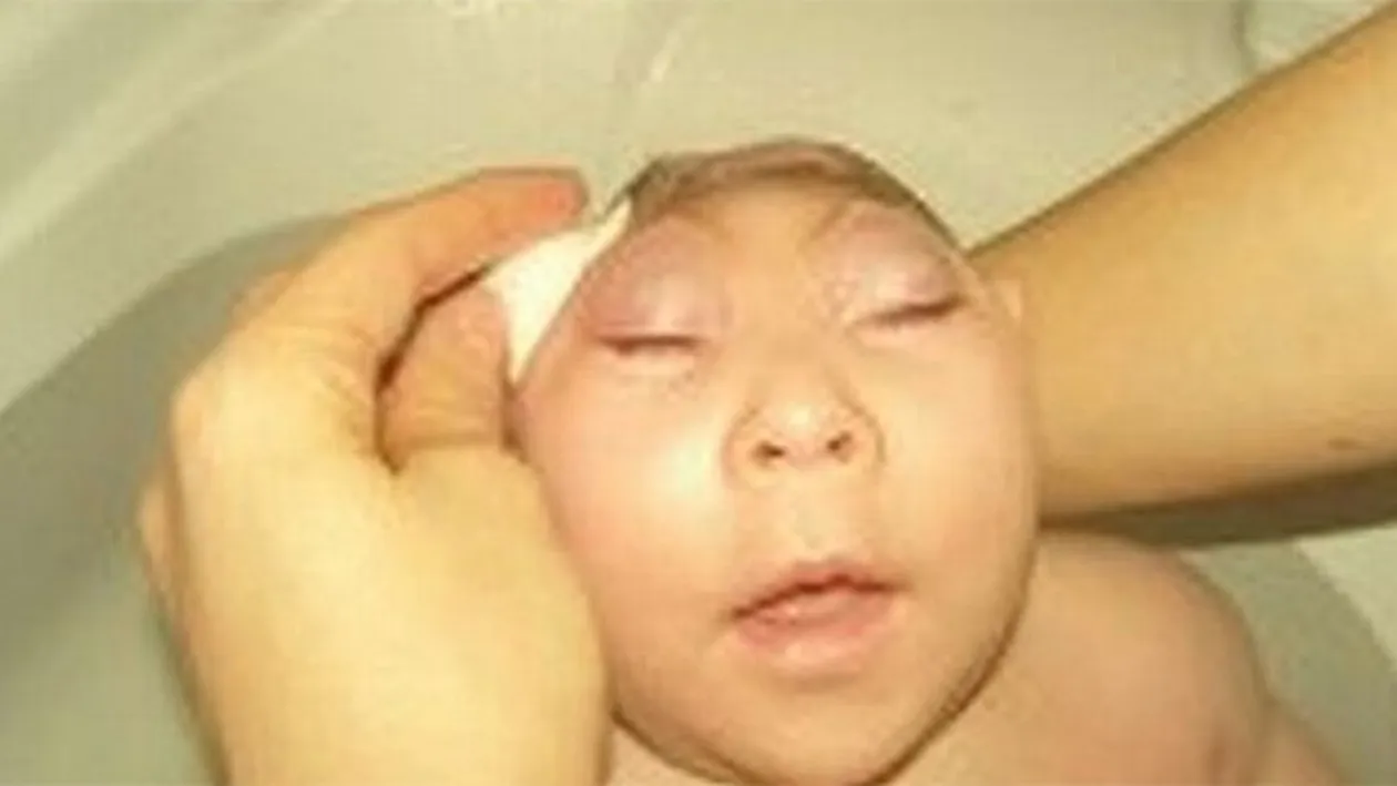 CUTREMURĂTOR! Cum s-a născut această copilă, pentru ca mama ei a consumat droguri in timpul sarcinii! Imagini greu de privit