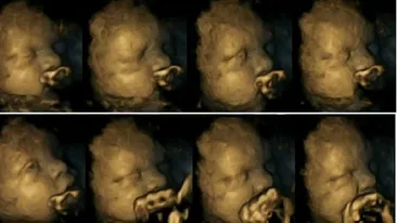 Fumezi in timpul sarcinii? Trebuie sa vezi asta! Cum reactioneaza fatul cand mama lui isi aprinde o tigara