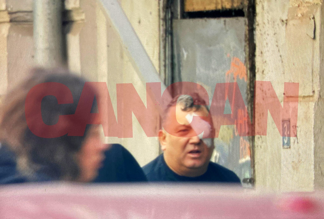 Nuredin Beinur, după ce a primit îngrijiri medicale (Foto: CANCAN.RO)