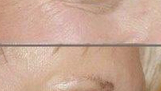 Doamnelor, exista o crema de ochi care va intinereste cu un an in doar doua minute!