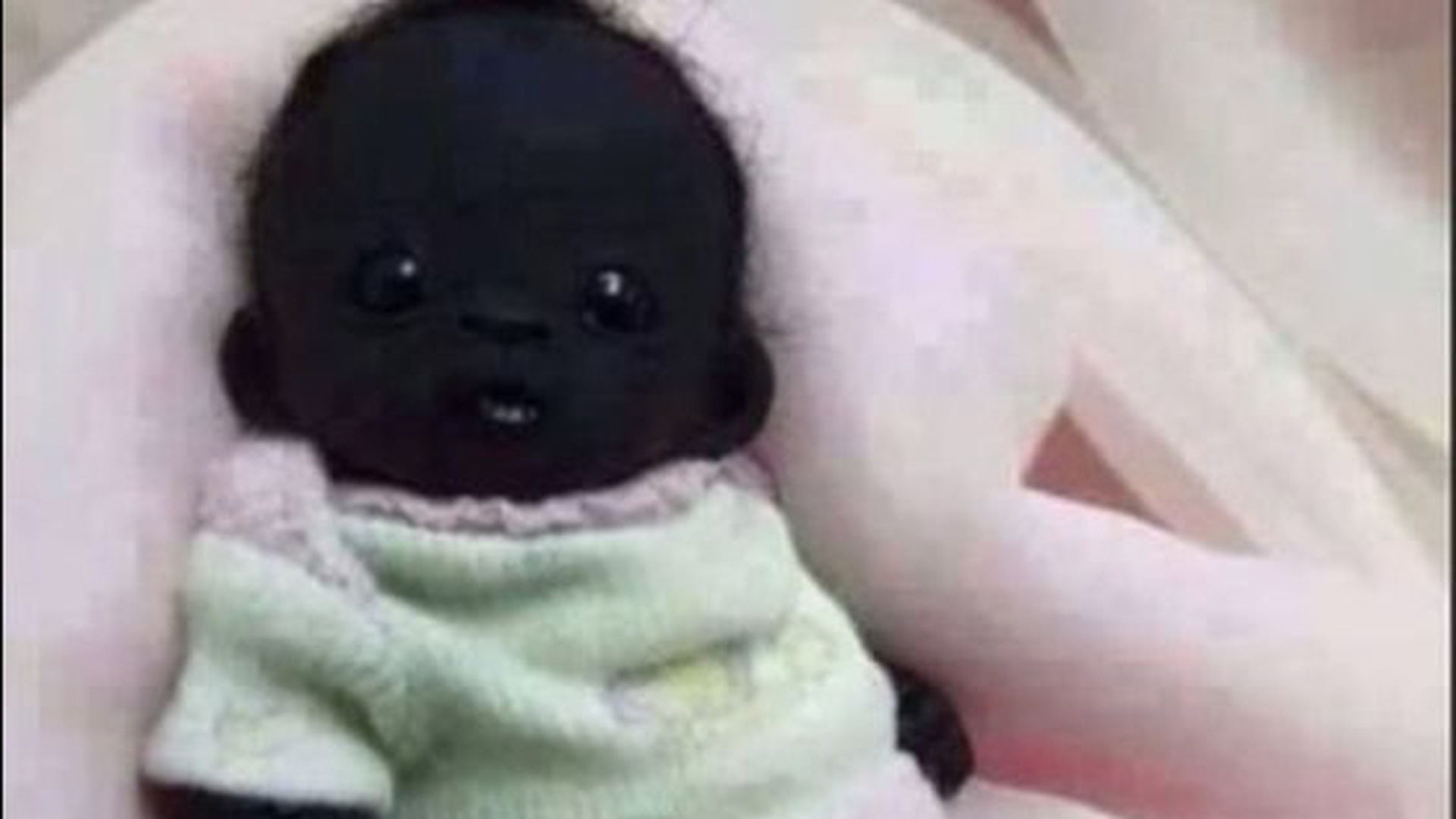 Vă mai amintiţi de Edam, cel mai negru bebeluş din lume? Iată cum arată acum, la 4 ani