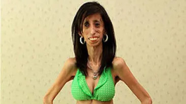 Imagini HORROR! Cum arata cea mai SLABA femeie din lume! Nu se poate INGRASA oricat de mult ar MANCA!