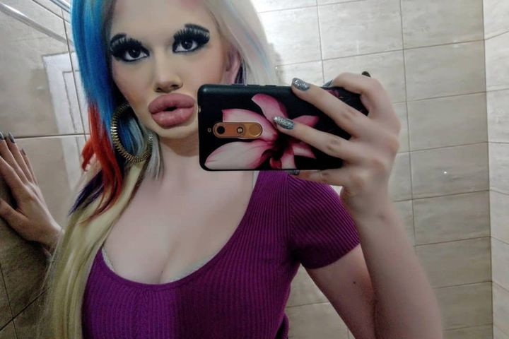 Andrea Ivanova are cele mai mari buze din lume. Cum arată după 20 de intervenții cu acid hialuronic. FOTO