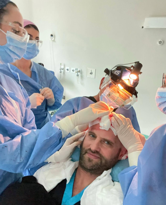 Sorin Brotnei de la Akcent și-a făcut din nou transplant de păr. Sursa foto: Instagram / Sorin Brotnei