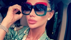 Bianca Drăguşanu şi-a mărit din nou buzele! Cum arată blonda după noua intervenţie estetică