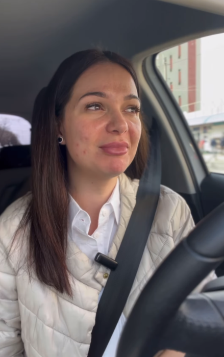 Deea Maxer are probleme cu acneea/ Sursa foto: Instagram