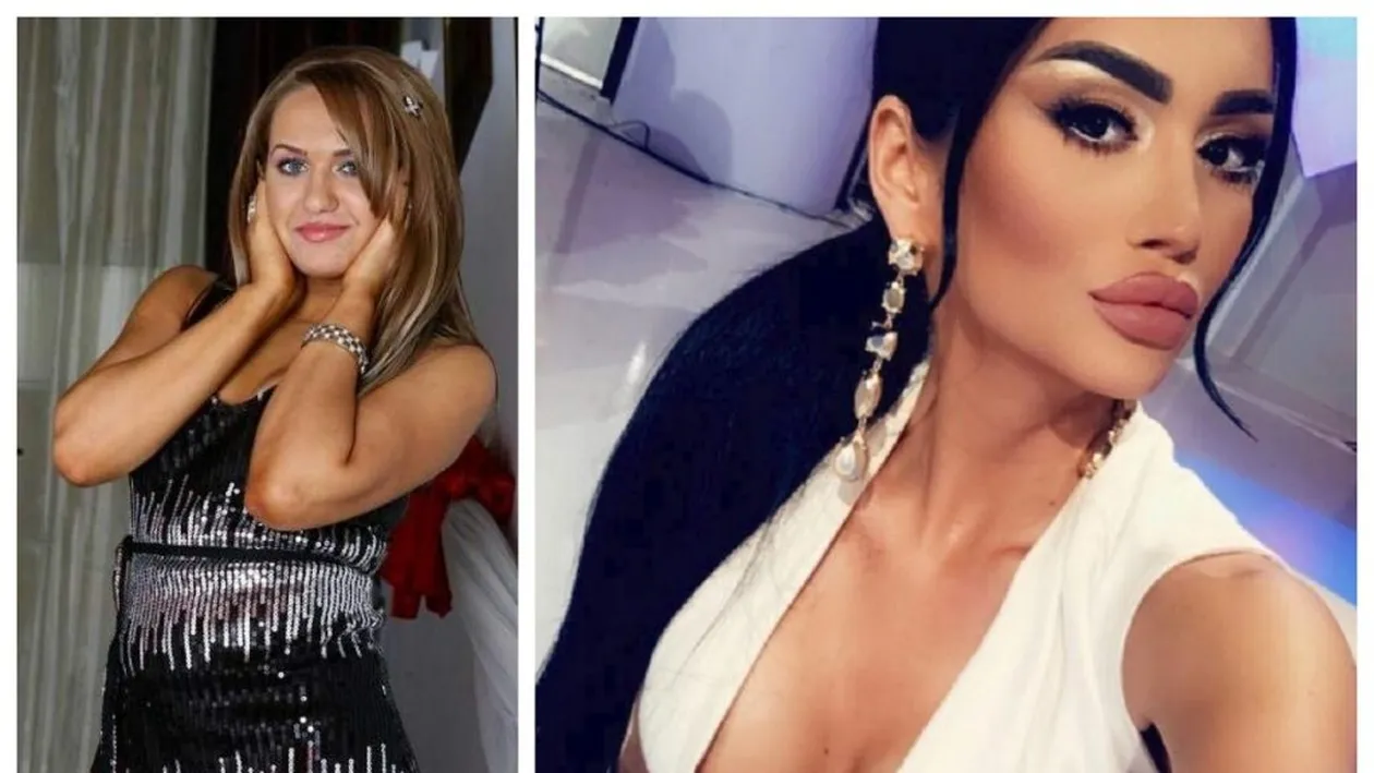 Câte operații are, de fapt, Margherita din Clejani. Tatăl său, reacție acidă după ce artista a apelat la estetician