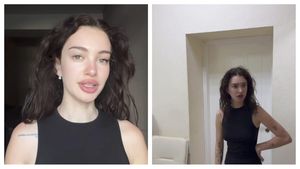 Olga Verbițchi, pe masa de operație. Ce a transmis artista înainte de anestezia totală